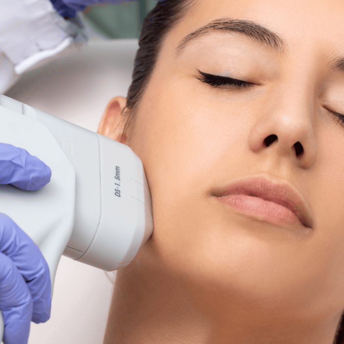 HIFU non-surgical skin tightening and lifting treatment