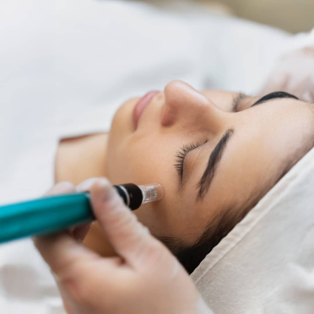 Microneedling and RF microneedling for collagen and firmer skin